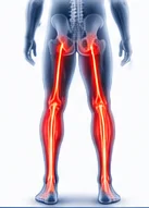 Estenosis espinal lumbar